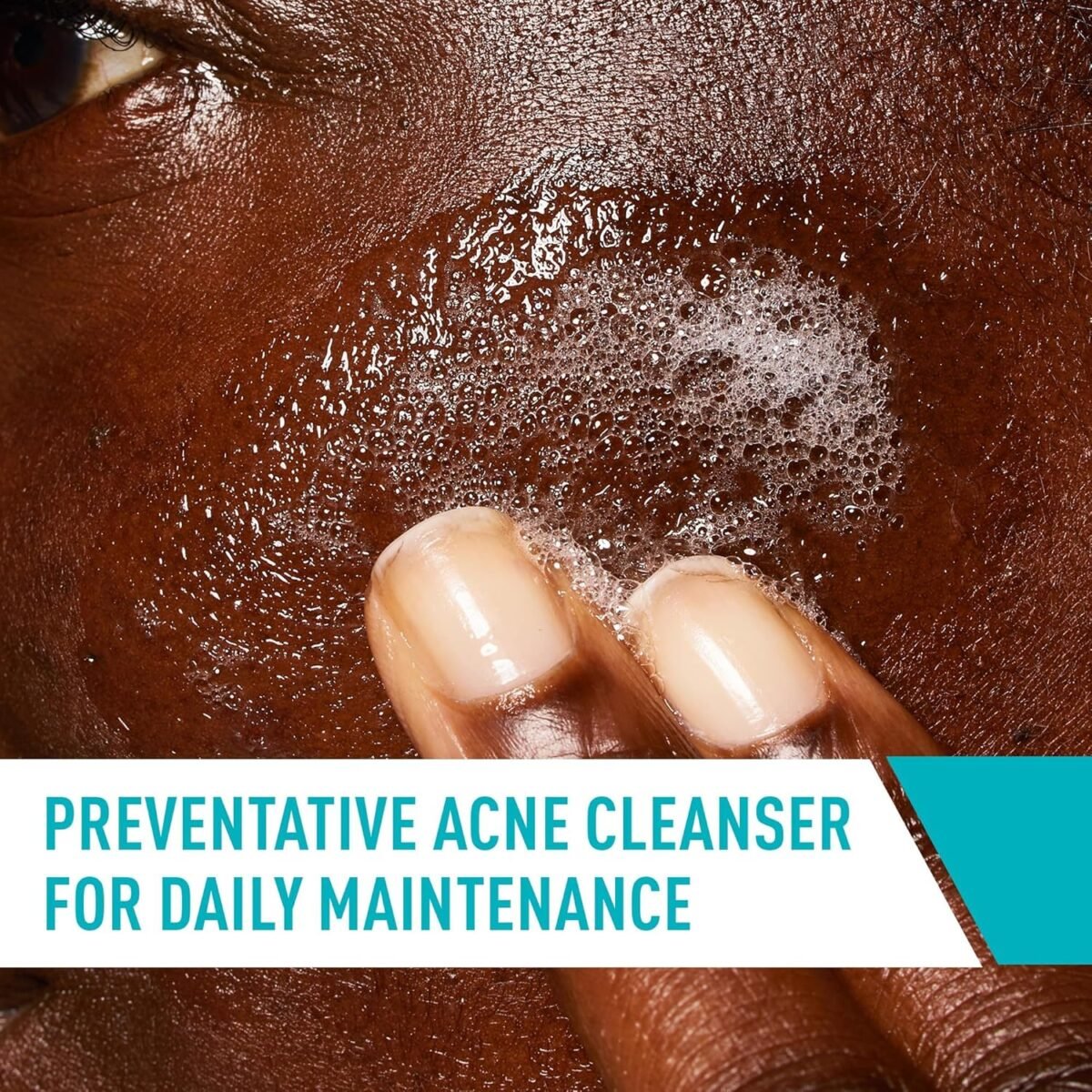 1749410921 cerave acne treatment face wash salicylic acid cleanser with purifying clay niacinamide and ceramides pore control and blackhead remover 8 ounce.jpg
