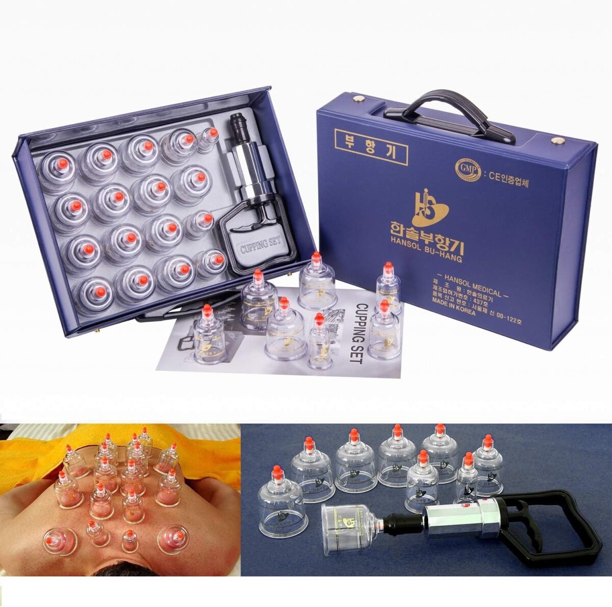 1750023272 hansol cupping therapy equipment set with pumping handle 17 cups made in korea.jpg