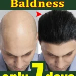 Rosemary hair growth essential oil, repair baldness and hair loss, seborrheic alopecia, hereditary hair loss, middle-aged hair l