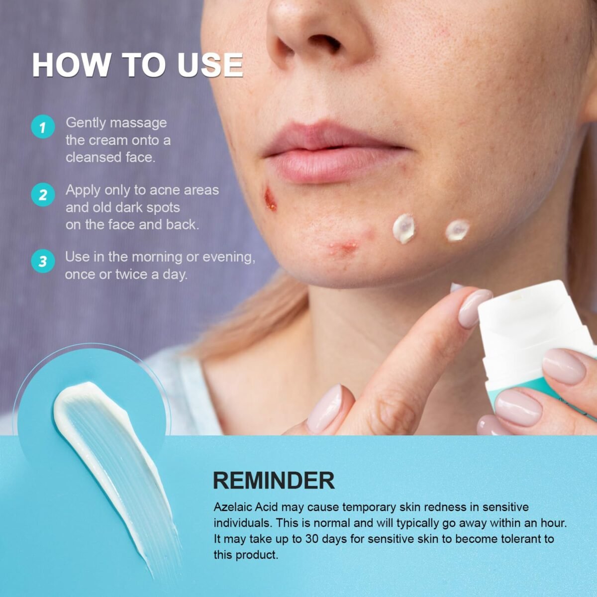 1752593731 acne pimple spot treatment cream cystic hormonal blackheads blemish breakouts for face back and body 10 azelaic acid salicylic acid teens adults 1.8 oz.jpg