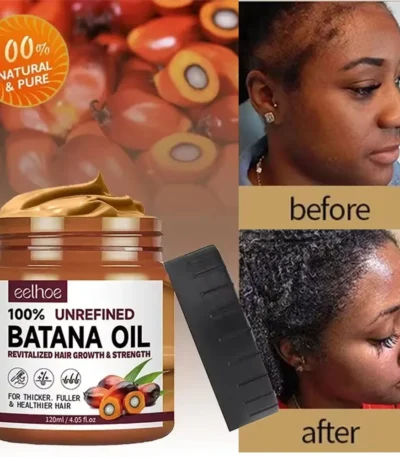 Batana Hair Growth Oil Conditioner Anti Hair Loss Products Fast Growing Hair Mask Nourishing Repair Roots Hair Care for women 1