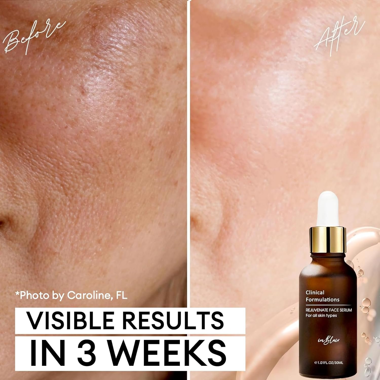 Rejuvenate Resurfacing Face Serum - Skin Care Serum for Face Wrinkles, Fine Lines, Dark Spots - Multi-Weight Hyaluronic Acid Formula for All Skin Types - 1 fl.oz. - Image 4